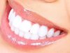 How Teeth Whitening Cost Matches Expectations