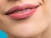 When Will I See Results After Lip Augmentation in Islamabad?