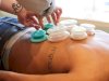 Cupping Therapy in Philadelphia: Ancient Healing Reimagined