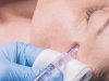 How Long Does Mesotherapy Last? A Complete Guide