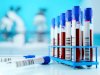 Signs You Shouldn’t Ignore That May Indicate the Need for Syphilis Screening