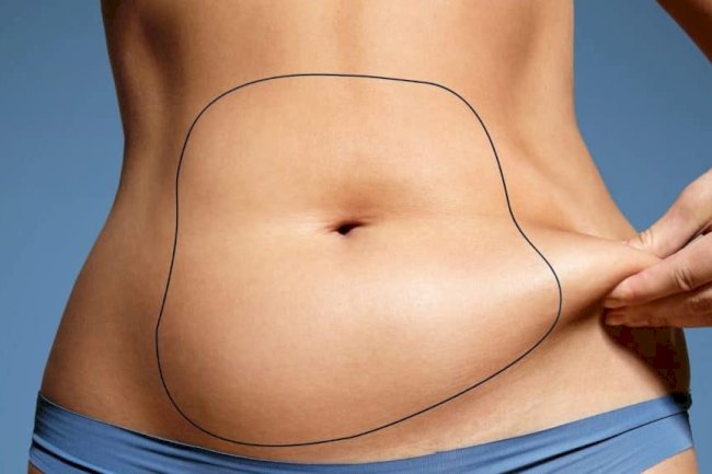 Expert Recovery Guidance from Best Liposuction Surgeons in Dubai