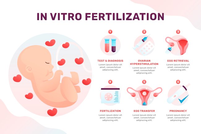 Best IVF Doctor in Delhi – Your Guide to Trusted Fertility Care