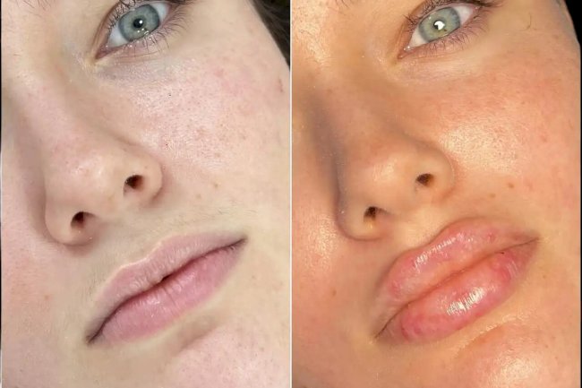 Best Plastic Surgeon in dubai for Fillers: How to Identify Genuine Reviews