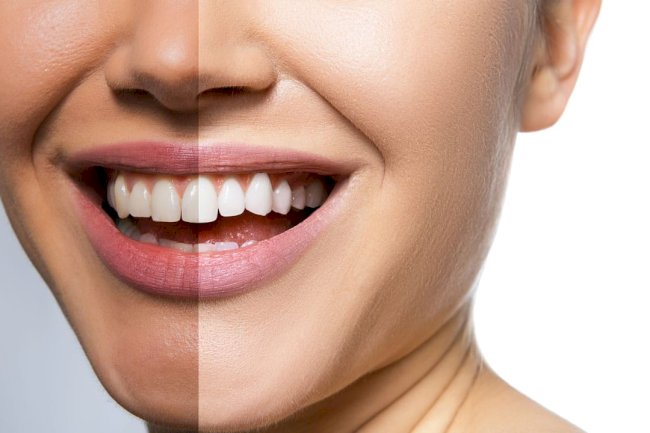 Complete Family Dental Care in Toronto: Your Smile Deserves the Best