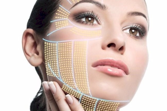 HIFU vs. RF (Radiofrequency): Which is More Effective in Islamabad?