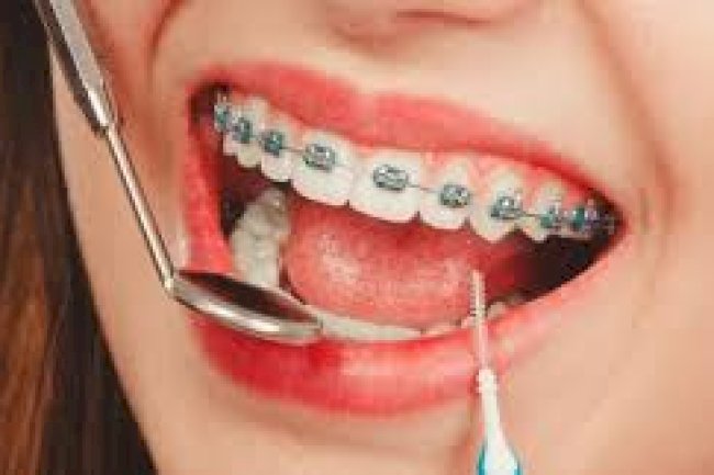 Tired of Searching "Orthodontist Close to Me"? Your Guide to Local Specialists Who Listen.