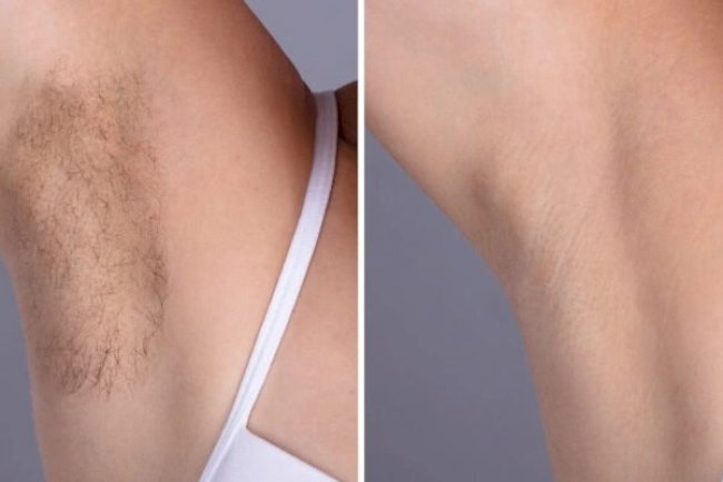 Best Plastic Surgeon in dubai Setting Standards in Laser Hair Removal