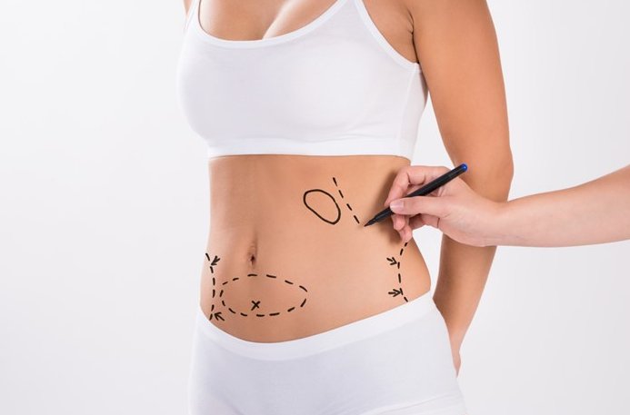 Sculpted Secrets: The Liposuction Obsession Behind the Glamour