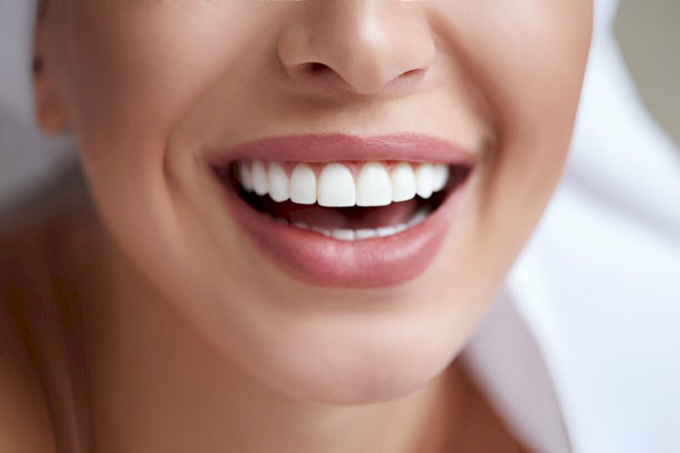 Top Cosmetic Dentists in Keller: What Makes Keller Family Dental Stand Out?