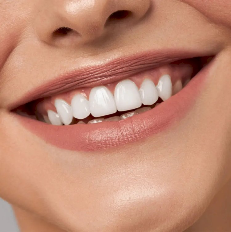 Does Teeth Whitening Work on Naturally Gray Teeth?