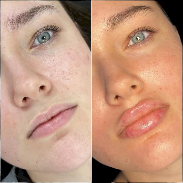 Best Plastic Surgeon in dubai for Fillers: How to Identify Genuine Reviews