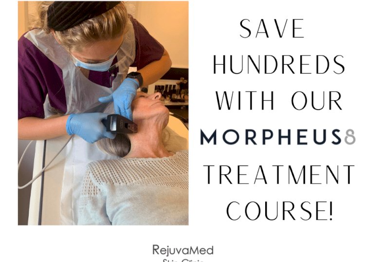 What Happens During a Morpheus8 Session? A Step-by-Step Treatment Overview