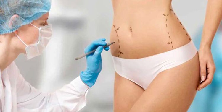 The Truth About Liposuction in Islamabad
