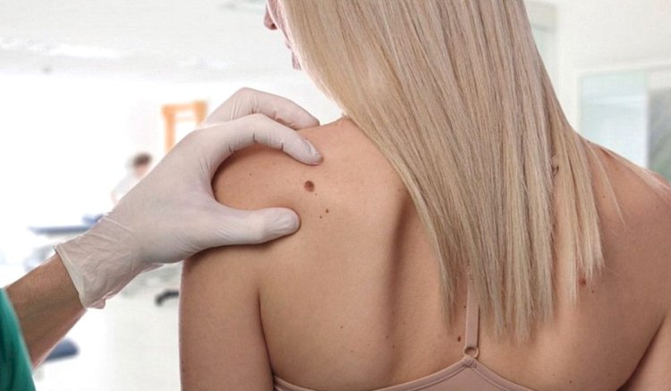 Fresh Start with Tag Removal Dubai