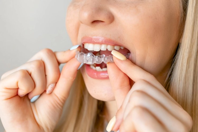Invisalign Braces Treatment: Tracking Progress Effectively