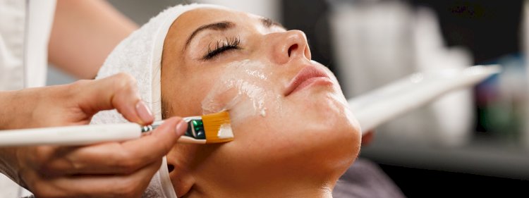 What Are the Benefits of Getting a Chemical Peel?