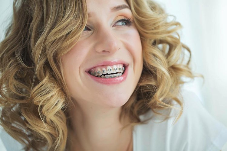 How Do Invisalign and Braces Orthodontics Compare for Treatment?