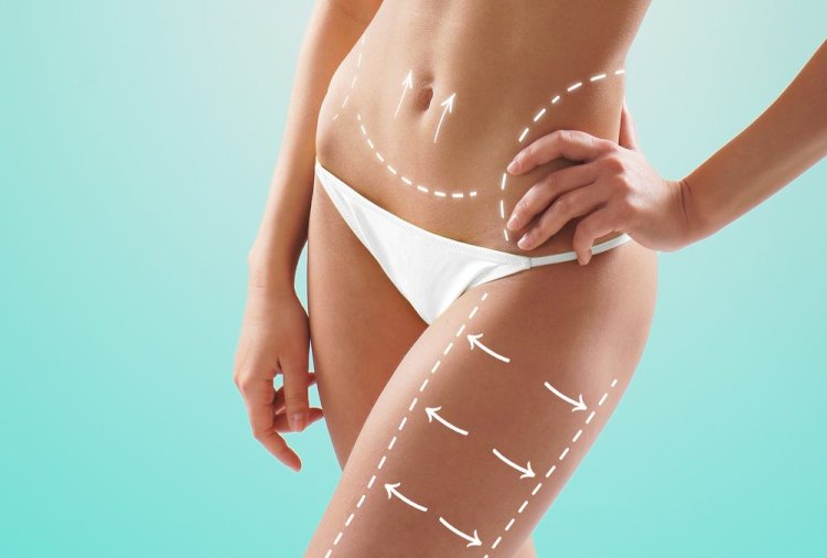 Tummy Tuck Pain Management Tips for a Comfortable Recovery