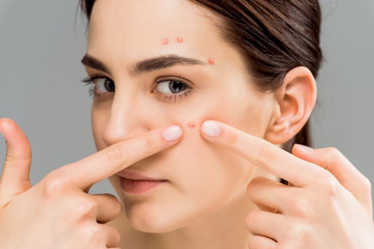 When Does Acne Treatment Dubai Show Real Results?