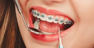 Tired of Searching "Orthodontist Close to Me"? Your Guide to Local Specialists Who Listen.